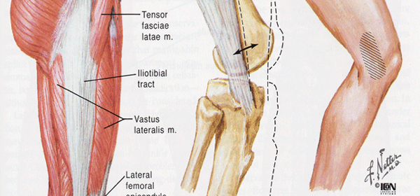 Iliotibial Band Syndrome (Runners Knee) 