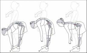 lumbopelvic rhythm contribute to low back pain