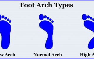 Foot arch types