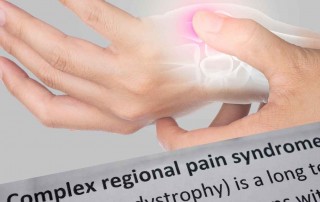 Complex regional pain syndrome