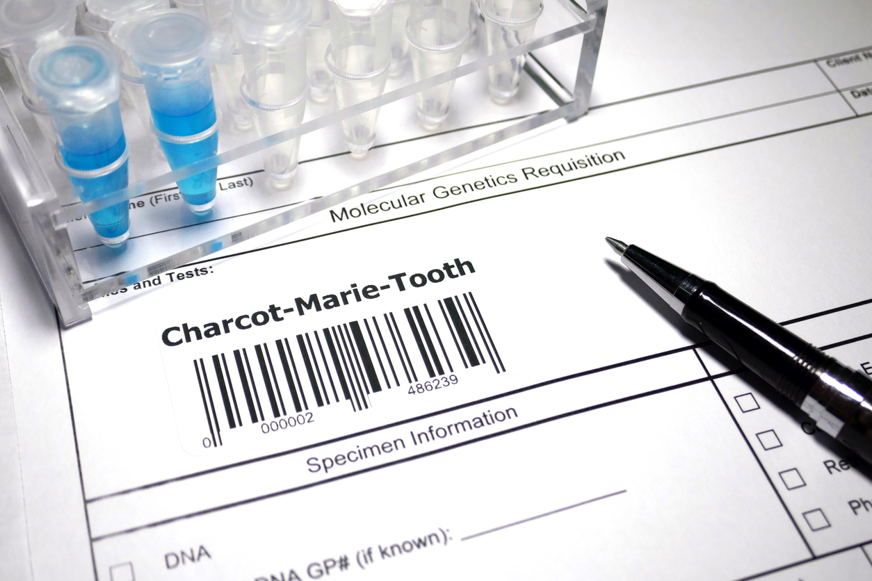 charcot marie tooth disease