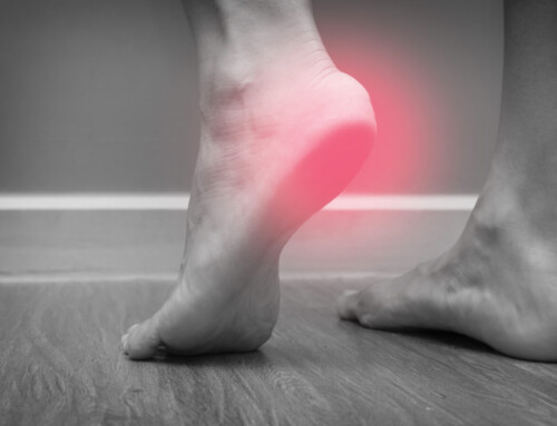 Overcoming Heel Pain with Physical Therapy